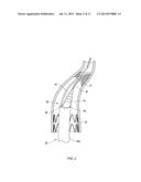 Retrieval Catheters and Methods of Retrieving Deployed Medical Devices diagram and image