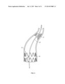 Retrieval Catheters and Methods of Retrieving Deployed Medical Devices diagram and image