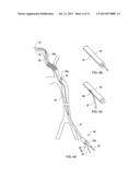 Retrieval Catheters and Methods of Retrieving Deployed Medical Devices diagram and image