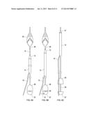 Retrieval Catheters and Methods of Retrieving Deployed Medical Devices diagram and image