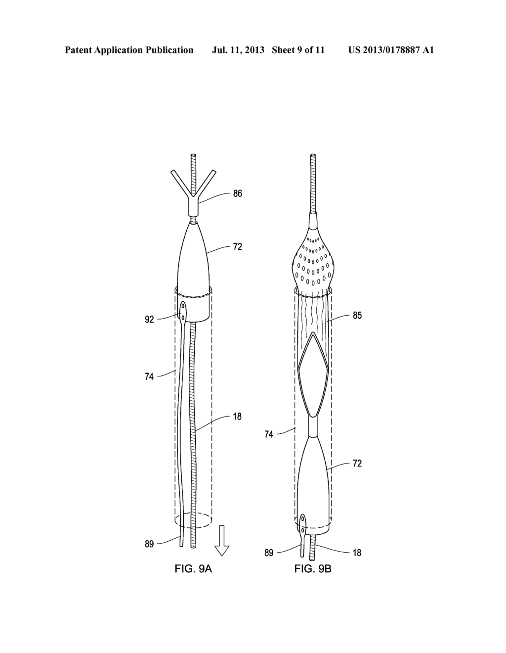 Retrieval Catheters and Methods of Retrieving Deployed Medical Devices - diagram, schematic, and image 10