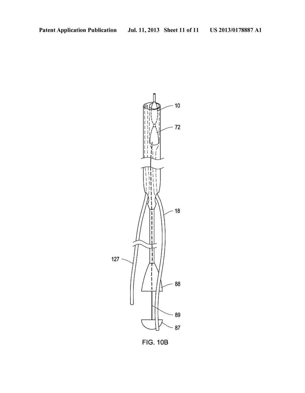 Retrieval Catheters and Methods of Retrieving Deployed Medical Devices - diagram, schematic, and image 12