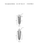 Porous Implants diagram and image