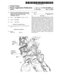 DEVICES AND METHODS TO PREVENT OR LIMIT SPONDLYLOLISTHESIS AND OTHER     ABERRANT MOVEMENTS OF THE VERTEBRAL BONES diagram and image