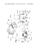 DEVICES AND METHODS TO PREVENT OR LIMIT SPONDLYLOLISTHESIS AND OTHER     ABERRANT MOVEMENTS OF THE VERTEBRAL BONES diagram and image