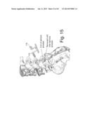 DEVICES AND METHODS TO PREVENT OR LIMIT SPONDLYLOLISTHESIS AND OTHER     ABERRANT MOVEMENTS OF THE VERTEBRAL BONES diagram and image