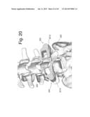 DEVICES AND METHODS TO PREVENT OR LIMIT SPONDLYLOLISTHESIS AND OTHER     ABERRANT MOVEMENTS OF THE VERTEBRAL BONES diagram and image