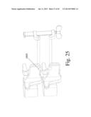 DEVICES AND METHODS TO PREVENT OR LIMIT SPONDLYLOLISTHESIS AND OTHER     ABERRANT MOVEMENTS OF THE VERTEBRAL BONES diagram and image