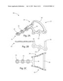 MODULAR BONE FIXATION SYSTEM diagram and image