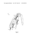 MODULAR BONE FIXATION SYSTEM diagram and image