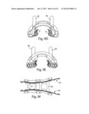 MODULAR BONE FIXATION SYSTEM diagram and image