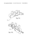 MODULAR BONE FIXATION SYSTEM diagram and image