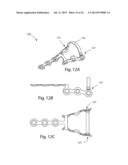 MODULAR BONE FIXATION SYSTEM diagram and image