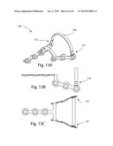 MODULAR BONE FIXATION SYSTEM diagram and image