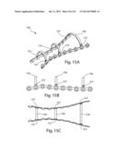 MODULAR BONE FIXATION SYSTEM diagram and image