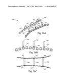 MODULAR BONE FIXATION SYSTEM diagram and image