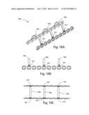 MODULAR BONE FIXATION SYSTEM diagram and image