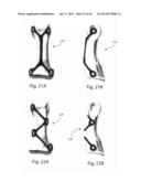 MODULAR BONE FIXATION SYSTEM diagram and image