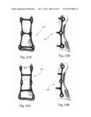 MODULAR BONE FIXATION SYSTEM diagram and image