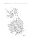 ELECTROPHYSIOLOGICAL ENDOCARDIOLOGY TOOL diagram and image