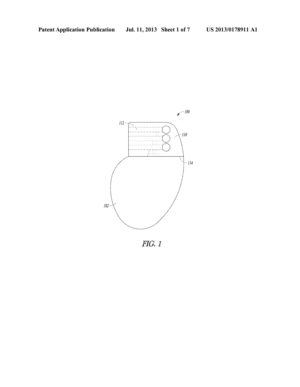 IMPLANTABLE DEVICE HEADER AND METHOD - diagram, schematic, and image 02