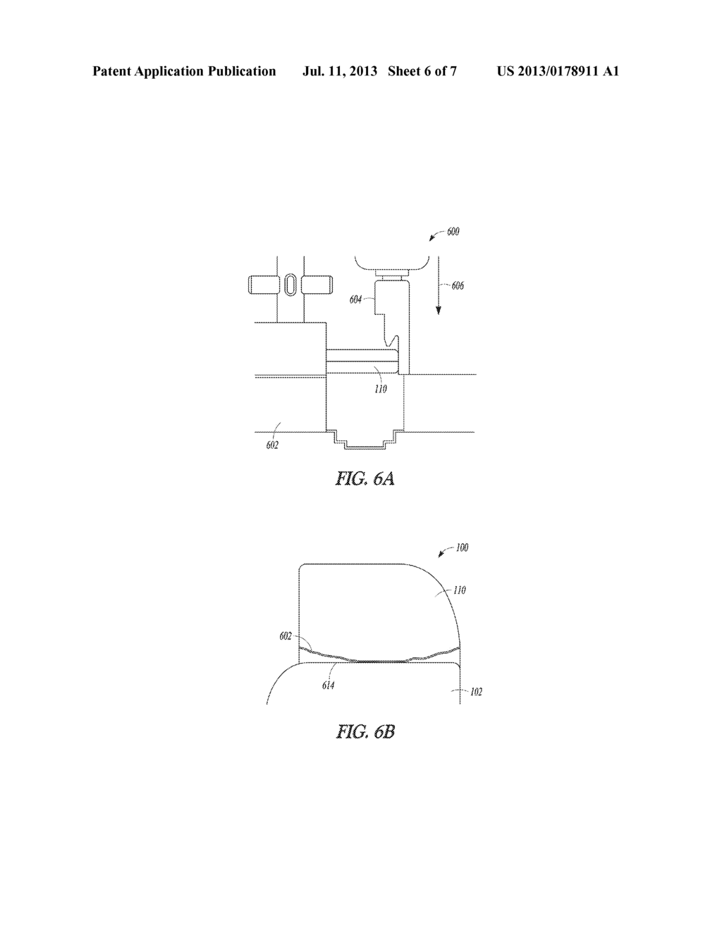 IMPLANTABLE DEVICE HEADER AND METHOD - diagram, schematic, and image 07