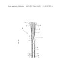 STENT DELIVERY SYSTEM diagram and image