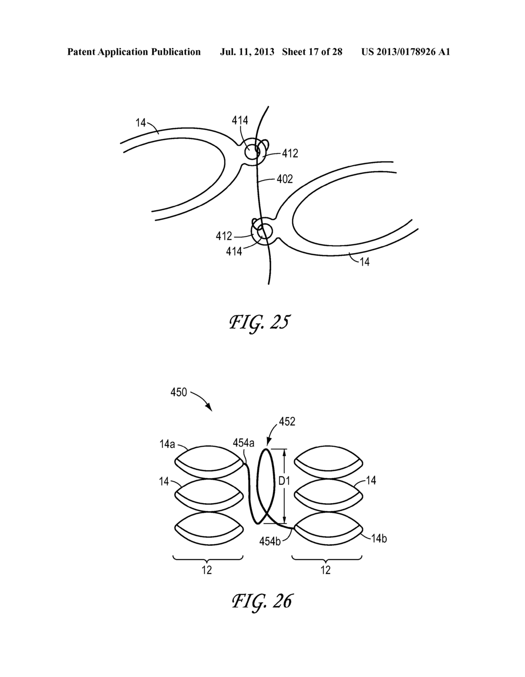 Stent Having At Least One Connecting Member Configured to Controllably     Sever In Vivo - diagram, schematic, and image 18