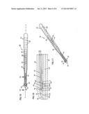 NASAL VALVE TREATMENT METHOD & APPARATUS diagram and image