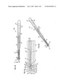 NASAL VALVE TREATMENT METHOD & APPARATUS diagram and image