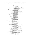 Intraluminal Stent diagram and image