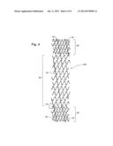 Intraluminal Stent diagram and image