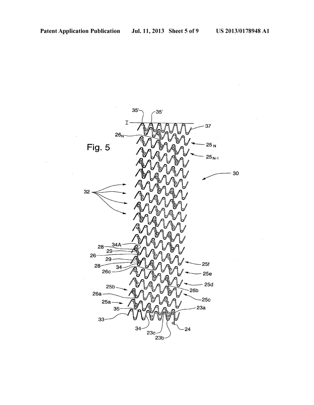 Intraluminal Stent - diagram, schematic, and image 06