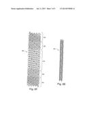 Intraluminal Stent diagram and image