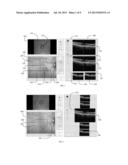 USER INTERFACE FOR EFFICIENTLY DISPLAYING RELEVANT OCT IMAGING DATA diagram and image