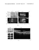 USER INTERFACE FOR EFFICIENTLY DISPLAYING RELEVANT OCT IMAGING DATA diagram and image