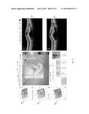 USER INTERFACE FOR EFFICIENTLY DISPLAYING RELEVANT OCT IMAGING DATA diagram and image