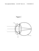 MULTI-FOCAL OPTICAL LENSES diagram and image