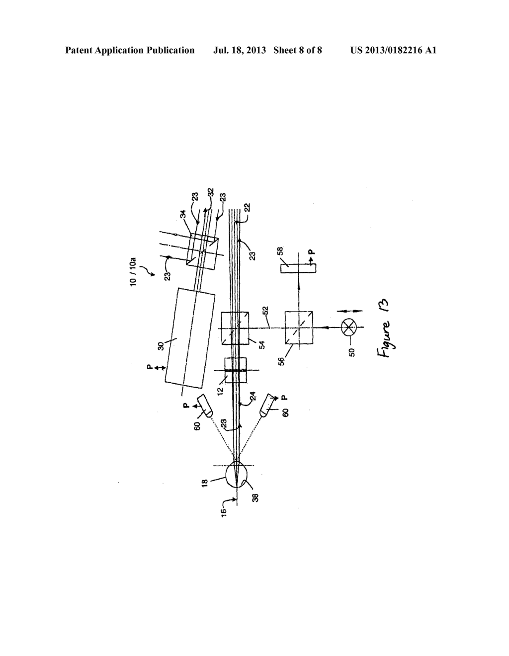 TREATING OCULAR REFRACTIVE ERROR - diagram, schematic, and image 09