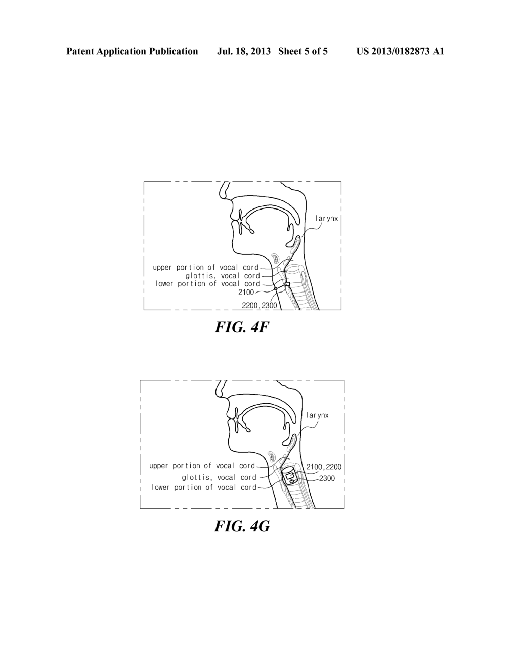 DEVICE FOR SUPPLEMENTING VOICE INCLUDING SENSING UNIT AND METHOD FOR     CONTROLLING THE SAME - diagram, schematic, and image 06