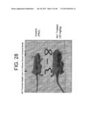 Antagonists of IL-6 to raise albumin and/or lower crp diagram and image