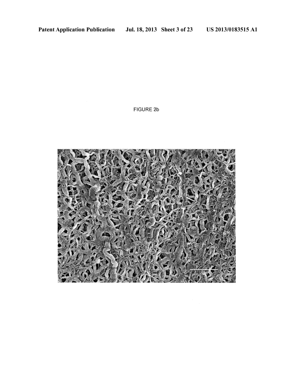 Articles including expanded polytetrafluoroethylene membranes with     serpentine fibrils - diagram, schematic, and image 04