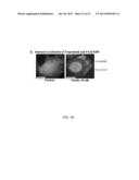 INSULIN RECEPTOR INDUCED ELASTIN PRODUCTION diagram and image