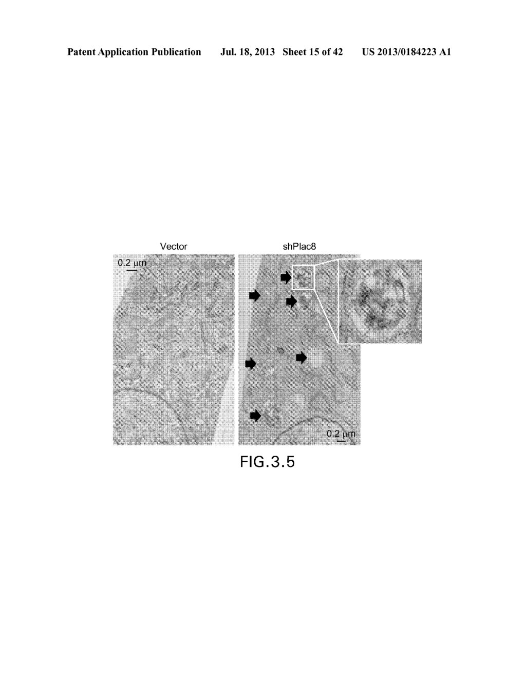 METHODS AND COMPOSITIONS RELATED TO MODULATING AUTOPHAGY - diagram, schematic, and image 16