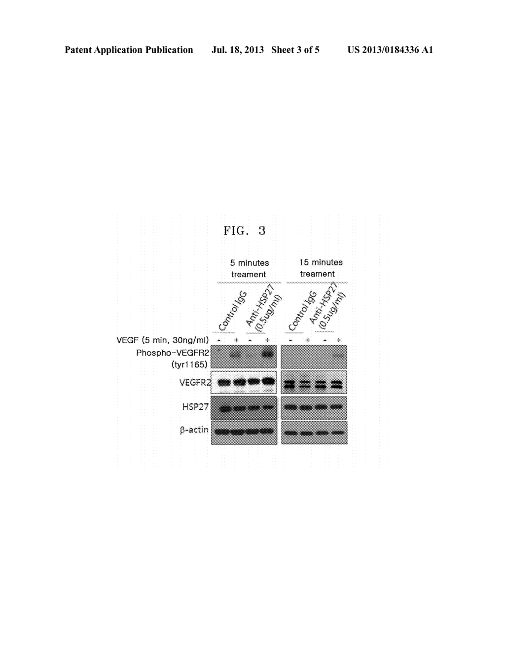 PHARMACEUTICAL COMPOSITION FOR SUPPRESSING ANGIOGENESIS, AND METHOD FOR     SCREENING ACTIVE MATERIAL FOR SUPPRESSING ANGIOGENESIS - diagram, schematic, and image 04