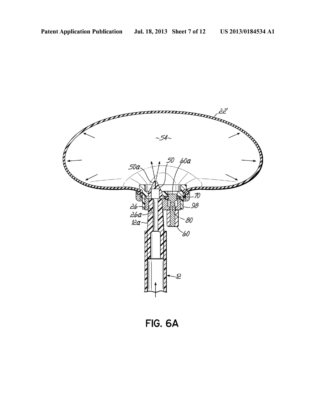 SYSTEMS, DEVICES AND METHODS FOR CREATING AN OPERATIVE SITE WITHIN A     PATIENT - diagram, schematic, and image 08