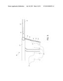 EXPANDABLE TISSUE RETRACTION DEVICES diagram and image