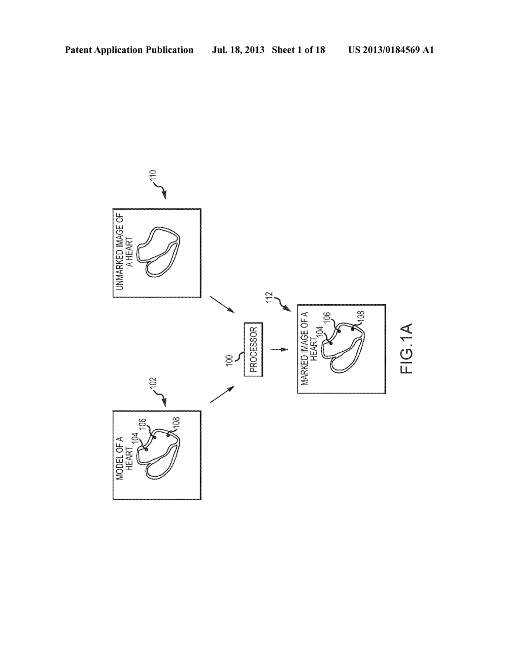 Method for producing an electrophysiological map of the heart - diagram, schematic, and image 02