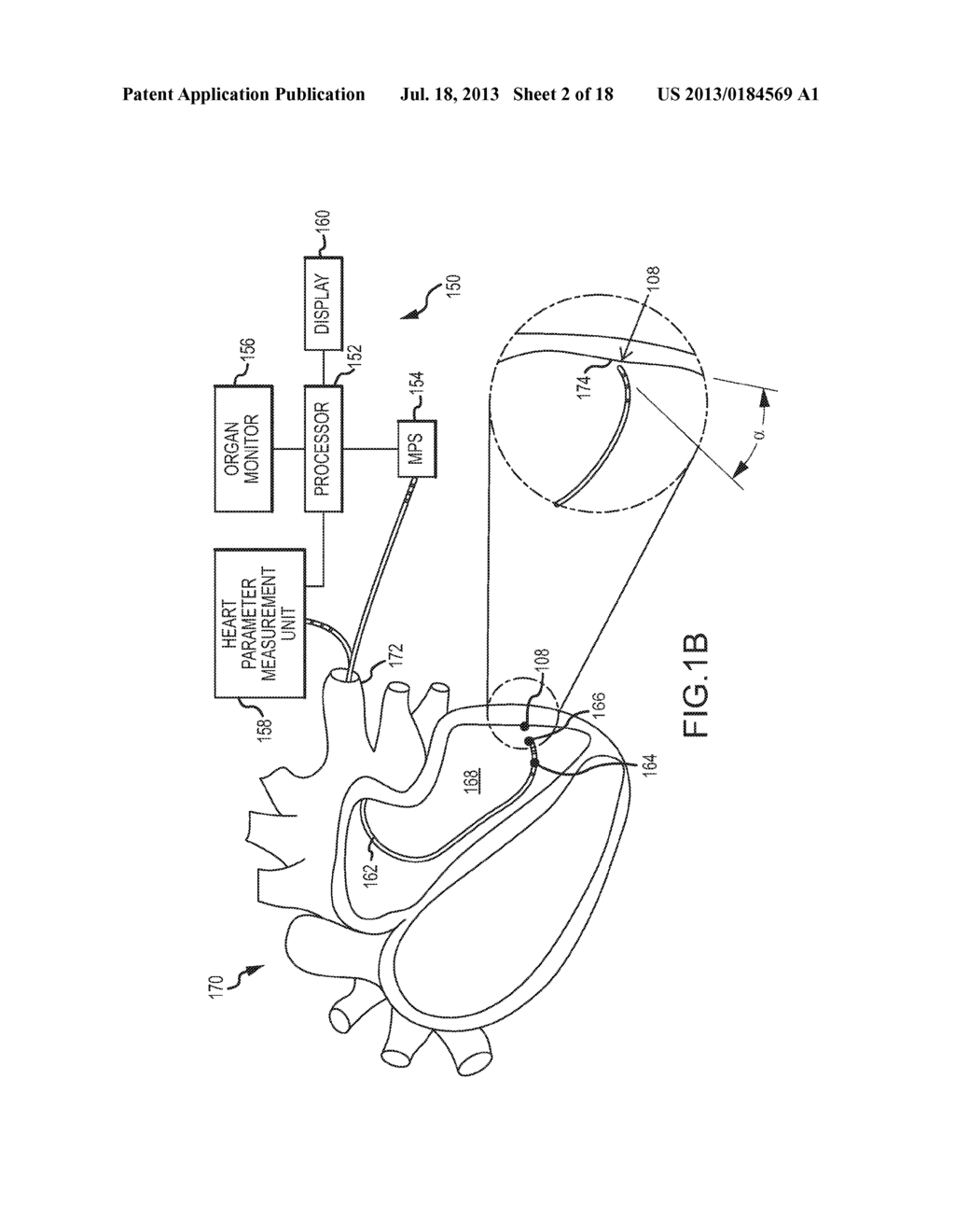 Method for producing an electrophysiological map of the heart - diagram, schematic, and image 03