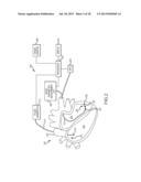 Method for producing an electrophysiological map of the heart diagram and image